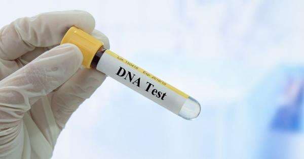 Biaya Tes DNA seperti yang Dijalani Ridwan Kamil, Segini Kisaran Harganya Biaya Tes DNA seperti yang Dijalani Ridwan Kamil, Segini Kisaran Harganya