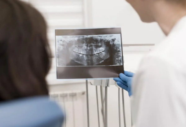 Estimasi Harga Rontgen Gigi Panoramic di Prodia, Intip Prosedur dan Kegunaannya Estimasi Harga Rontgen Gigi Panoramic di Prodia, Intip Prosedur dan Kegunaannya
