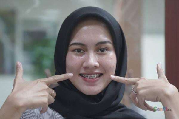 Apakah Punya Gigi Tak Rapi Bisa Daftar PKN STAN? Simak Penjelasan Berikut Ini Apakah Punya Gigi Tak Rapi Bisa Daftar PKN STAN? Simak Penjelasan Berikut Ini