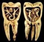 Artefak Kuno Ini Sebut Sakit Gigi sebagai Gambaran Siksa Neraka Artefak Kuno Ini Sebut Sakit Gigi sebagai Gambaran Siksa Neraka