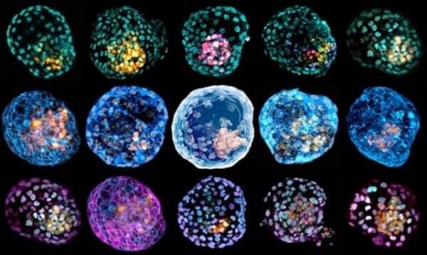 Bagaimana Terbentuknya Embrio Manusia? Alquran dan Sains Beri Penjelasannya
