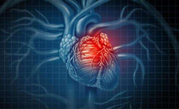 Bahan Kimia dalam Plastik Dikaitkan dengan Kematian Akibat Penyakit Jantung Bahan Kimia dalam Plastik Dikaitkan dengan Kematian Akibat Penyakit Jantung