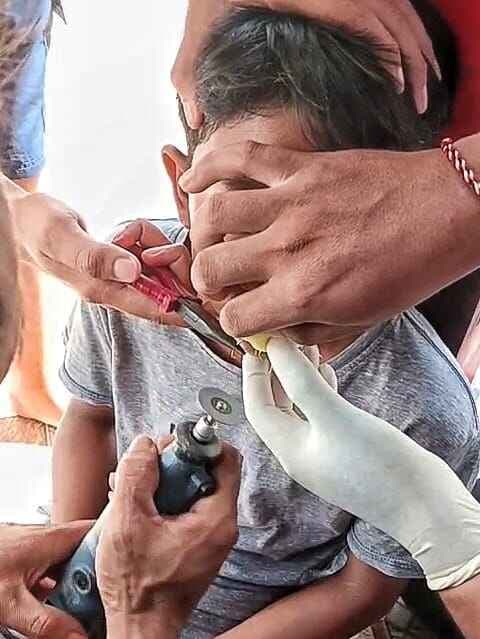 Dramatis, Petugas Damkar Katingan Evakuasi Kail Pancing yang Tersangkut di Bibir Remaja 12 Tahun Dramatis, Petugas Damkar Katingan Evakuasi Kail Pancing yang Tersangkut di Bibir Remaja 12 Tahun