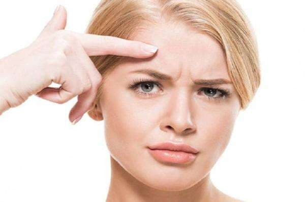 Bikin Insecure, Ini 7 Cara Menghilangkan Kerutan pada Dahi Bikin Insecure, Ini 7 Cara Menghilangkan Kerutan pada Dahi