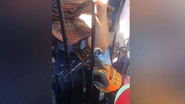 Tragis! Siku Tangan Bocah SD Tertusuk Pagar Besi Sekolah di Makassar Tragis! Siku Tangan Bocah SD Tertusuk Pagar Besi Sekolah di Makassar