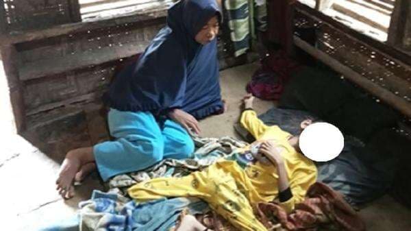 Kisah Pilu Bocah di Lebak Stunting Berat karena Keterbatasan Ekonomi, Kondisinya Mengenaskan Kisah Pilu Bocah di Lebak Stunting Berat karena Keterbatasan Ekonomi, Kondisinya Mengenaskan