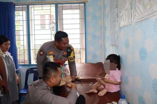 Struktur Kaki Bocah Ini Melintir Patah, Polres Nias Selatan Lakukan Penyelidikan Struktur Kaki Bocah Ini Melintir Patah, Polres Nias Selatan Lakukan Penyelidikan