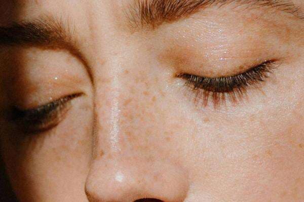 Tips Menghilangkan Flek Hitam Secara Alami, Dokter Ungkap Manfaat Bahan Herbal yang Aman di Rumah Tips Menghilangkan Flek Hitam Secara Alami, Dokter Ungkap Manfaat Bahan Herbal yang Aman di Rumah