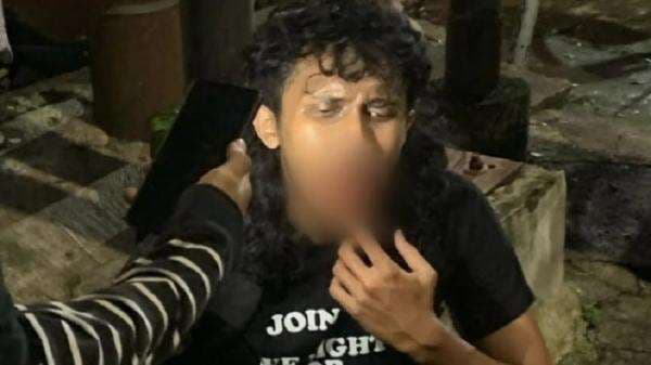 2 Demonstran Terluka saat Bentrok dengan Aparat Masih Dirawat di RS 2 Demonstran Terluka saat Bentrok dengan Aparat Masih Dirawat di RS