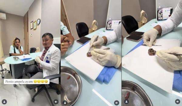 Mengenal Lipoma Mirip Ampla Ati yang Dialami Lina Mukherjee, Apa Penyebabnya? Mengenal Lipoma Mirip Ampla Ati yang Dialami Lina Mukherjee, Apa Penyebabnya?