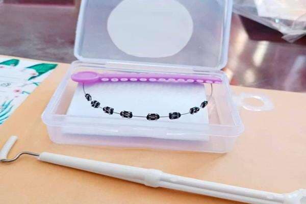 Hukum Memakai Behel dalam Islam, Begini Penjelasannya Hukum Memakai Behel dalam Islam, Begini Penjelasannya