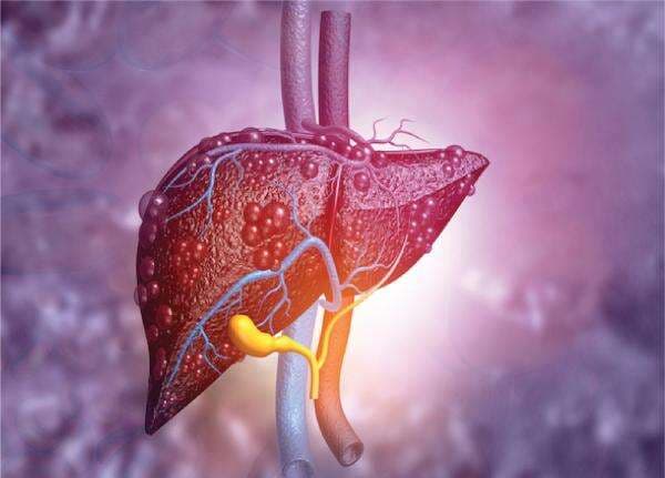 Ilmuwan Kembangkan AI untuk Memprediksi Risiko Gejala Kanker Hati Ilmuwan Kembangkan AI untuk Memprediksi Risiko Gejala Kanker Hati
