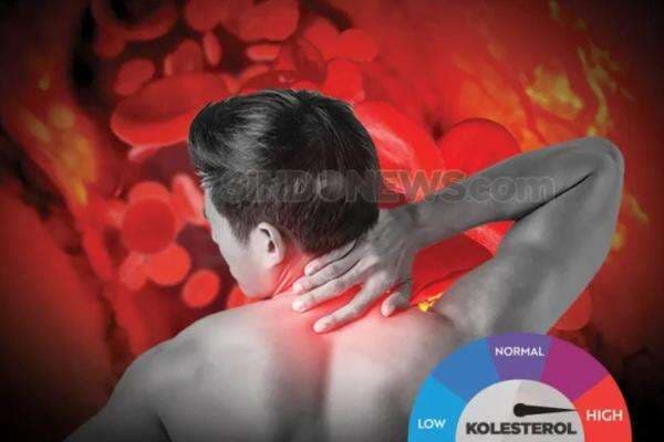 Kenali Gejala Asam Urat di Leher, Nyeri Punggung hingga Leher Kaku Kenali Gejala Asam Urat di Leher, Nyeri Punggung hingga Leher Kaku