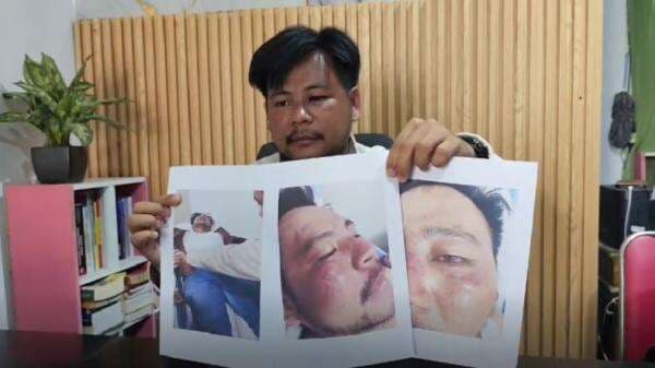 Dikeroyok Preman dan Aparat saat Demo Pati, Kuasa Hukum Warga: Saya Diinjak Ditendang Dikeroyok Preman dan Aparat saat Demo Pati, Kuasa Hukum Warga: Saya Diinjak Ditendang