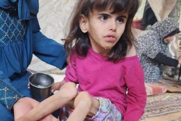 Lebih dari 2.700 Anak Balita Didiagnosis Terkena Malnutrisi Akut di Gaza Lebih dari 2.700 Anak Balita Didiagnosis Terkena Malnutrisi Akut di Gaza