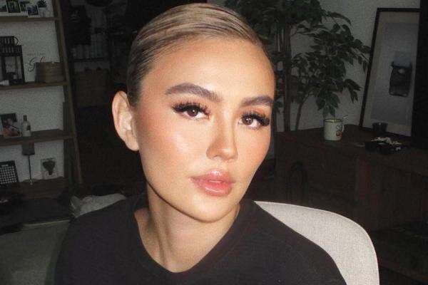 Mengenal Alopecia Areata, Penyakit yang Menjangkit Agnez Mo hingga Alami Kebotakan Mengenal Alopecia Areata, Penyakit yang Menjangkit Agnez Mo hingga Alami Kebotakan