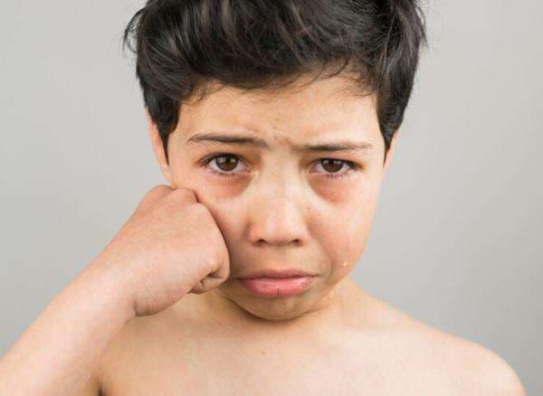 Kenali Penyebab dan Penanganan Neuralgia Trigeminal, Penyakit yang Menyerang Saraf Wajah Kenali Penyebab dan Penanganan Neuralgia Trigeminal, Penyakit yang Menyerang Saraf Wajah