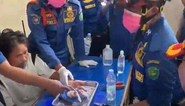 Dramatis, Aksi Petugas Damkar Bengkulu Lepas 18 Cincin dari Jari Pasien ODGJ Dramatis, Aksi Petugas Damkar Bengkulu Lepas 18 Cincin dari Jari Pasien ODGJ
