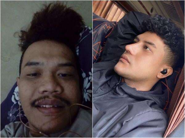 Pria Ini 10 Kali Operasi Wajah karena Kesal Susah Dapat Kerja, Hasilnya Bikin Kaget Pria Ini 10 Kali Operasi Wajah karena Kesal Susah Dapat Kerja, Hasilnya Bikin Kaget