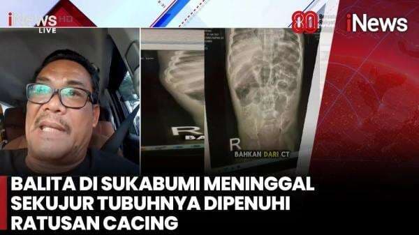 Dinkes Sukabumi Buka Suara soal Balita Tewas Digerogoti Cacing Dinkes Sukabumi Buka Suara soal Balita Tewas Digerogoti Cacing