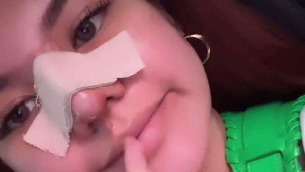 Shafa Harris Lebih Pilih Oplas Hidung daripada Filler, Kenapa? Shafa Harris Lebih Pilih Oplas Hidung daripada Filler, Kenapa?