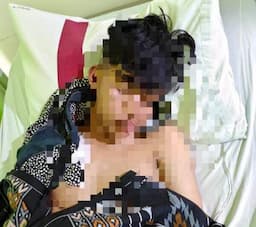 Tawuran di Ciomas Bogor, Satu Korban Terluka Akibat Tembakan Air Softgun   