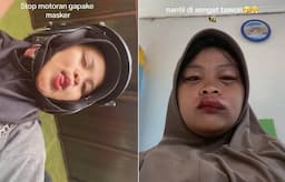 Viral Perempuan Ini Curhat Penyesalan Gak pake masker saat Naik motor, Bibirnya Disengat Tawon