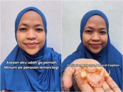 Viral Kisah Perempuan Kehilangan Gigi Gegara Hobi Minum Perasan Jeruk Nipis untuk Turunkan Berat Badan Viral Kisah Perempuan Kehilangan Gigi Gegara Hobi Minum Perasan Jeruk Nipis untuk Turunkan Berat Badan
