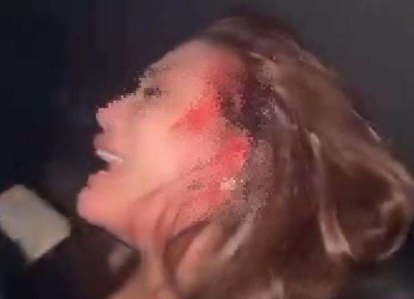 Viral! Perempuan Canrtik Histeris Kepala Berdarah Diduga Dipukul Senpi Viral! Perempuan Canrtik Histeris Kepala Berdarah Diduga Dipukul Senpi